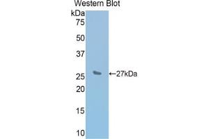 Western blot analysis of the recombinant protein. (IL2 Receptor beta antibody  (AA 27-240))