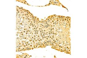Immunohistochemistry of paraffin embedded rat testis using HOXC9 (ABIN7074251) at dilution of 1:700 (300x lens) (HOXC9 antibody)