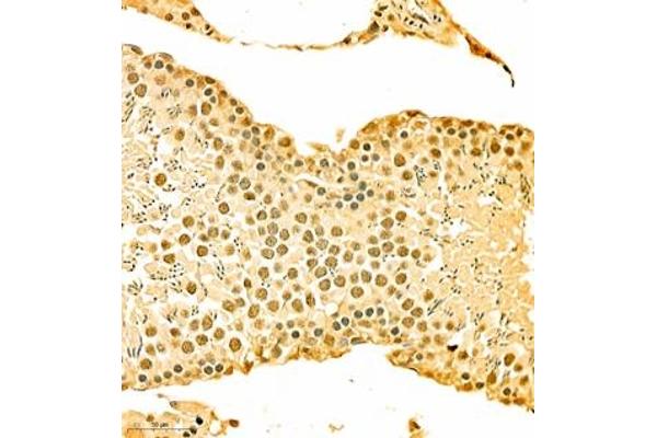 HOXC9 antibody