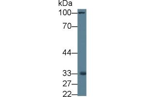 Western Blot; Sample: Rat Liver lysate; Primary Ab: 1µg/ml Rabbit Anti-Rat MRPL1 Antibody Second Ab: 0. (MRPL1 antibody  (AA 141-323))