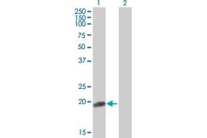 Fibronectin 1 antibody  (AA 1-163)