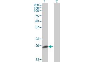 Western Blot analysis of FN1 expression in transfected 293T cell line by FN1 MaxPab polyclonal antibody. (Fibronectin 1 antibody  (AA 1-163))