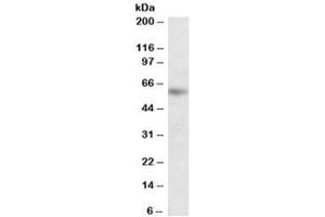 Western blot testing of human peripheral lymphocytes lysate with PIAS2 antibody at 1ug/ml. (PIAS2 antibody)
