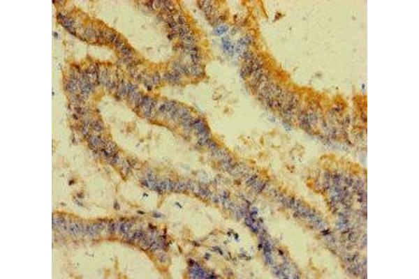 FAU antibody  (AA 1-59)