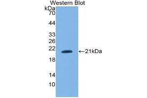Western blot analysis of the recombinant protein. (SNRPC antibody  (AA 2-159))