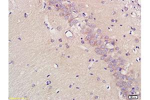 Formalin-fixed and paraffin embedded rat brain labeled with Anti-EAAT2, Unconjugated (ABIN733928) at 1:200, followed by conjugation to the secondary antibody and DAB staining (SLC1A2 antibody  (AA 101-200))