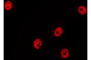 ABIN6269353 staining Hela by IF/ICC. (HDAC1 antibody  (C-Term))