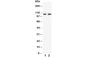 Western blot testing of EphB3 antibody and Lane 1:  HeLa