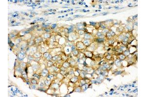 Immunohistochemistry (IHC) image for anti-Sequestosome 1 (SQSTM1) (AA 69-96), (N-Term) antibody (ABIN3043937)