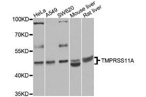 Western blot analysis of extracts of various cell lines, using TMPRSS11A antibody (ABIN5995991) at 1/1000 dilution. (TMPRSS11A antibody)