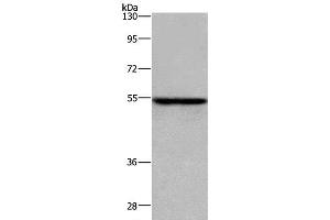 Western Blot analysis of MCF-7 cell using ETS2 Polyclonal Antibody at dilution of 1:300 (ETS2 antibody)