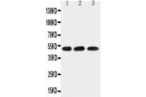 Anti-HYAL1 antibody,  Western blotting Lane 1: HELA Cell Lysate Lane 2: 22RV1 Cell Lysate Lane 3: MCF-7 Cell Lysate