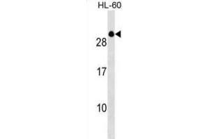 Western Blotting (WB) image for anti-Transcription Elongation Factor A (SII)-Like 2 (TCEAL2) antibody (ABIN3000105) (TCEAL2 antibody)