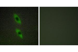 Peptide - +Immunohistochemistry analysis of paraffin-embedded human liver carcinoma tissue using FADD antibody. (FADD antibody)
