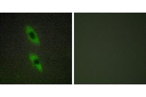 Peptide - +Immunohistochemistry analysis of paraffin-embedded human liver carcinoma tissue using FADD antibody. (FADD antibody)