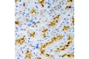 Immunohistochemical analysis of p43 staining in rat kidney formalin fixed paraffin embedded tissue section. (p43 antibody)