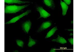 Immunofluorescence of monoclonal antibody to DDX43 on HeLa cell. (DDX43 antibody  (AA 2-90))