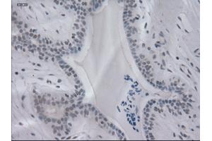 Immunohistochemical staining of paraffin-embedded breast using anti-IL-3 (ABIN2452543) mouse monoclonal antibody. (IL-3 antibody  (AA 20-152))