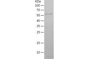 Western Blotting (WB) image for Annexin A5 (ANXA5) (AA 1-319) protein (His-EGFP Tag) (ABIN7121846) (Annexin V Protein (AA 1-319) (His-EGFP Tag))
