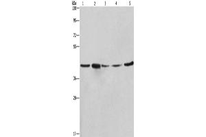 Western Blotting (WB) image for anti-Ribosomal Protein SA (RPSA) antibody (ABIN2421848) (RPSA/Laminin Receptor antibody)