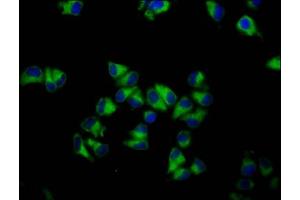 Immunofluorescence staining of Hela cells with ABIN7154731 at 1:133, counter-stained with DAPI. (GNA12 antibody  (AA 112-270))
