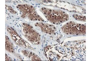 Immunohistochemical staining of paraffin-embedded Human Kidney tissue using anti-FBXO21 mouse monoclonal antibody.