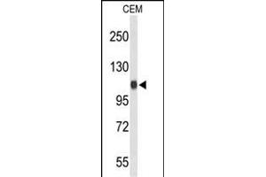 Western blot analysis of IPO11 Antibody (C-term) (ABIN653614 and ABIN2842973) in CEM cell line lysates (35 μg/lane). (Importin 11 antibody  (C-Term))