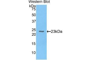 Detection of Recombinant CBX3, Human using Polyclonal Antibody to Chromobox Homolog 3 (CBX3) (CBX3 antibody  (AA 1-183))