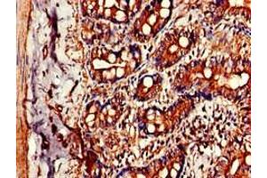 Immunohistochemistry of paraffin-embedded human small intestine tissue using ABIN7147277 at dilution of 1:100 (CIDEB antibody  (AA 80-145))