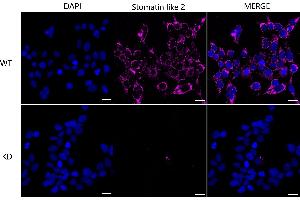 Immunocytochemical staining of HeLa cells using Stomatin like 2 antibody (ABIN7800442), 1:1,000), Top panel: wild-type (WT), Bottom panal: Stomatin like 2 shRNA knockdown (KD).