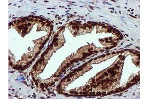 Image no. 3 for anti-EPM2A (Laforin) Interacting Protein 1 (EPM2AIP1) antibody (ABIN1498045) (EPM2AIP1 antibody)