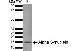 SDS-PAGE of ~14 kDa Type 1 Mouse Recombinant Alpha Synuclein Protein Pre-formed Fibrils (ABIN5651245, ABIN5651246 and ABIN5651247).