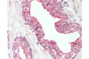 Human Prostate: Formalin-Fixed, Paraffin-Embedded (FFPE). (TSPAN1 antibody  (AA 143-192))