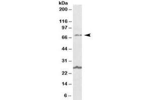 Western blot testing of human olfactory bulb lysate with SLC6A12 antibody at 1ug/ml. (SLC6A12 antibody)