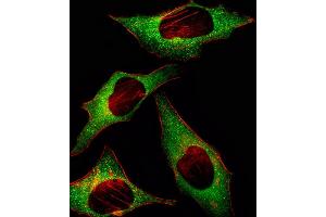 Fluorescent image of Hela cell stained with HIP2 Antibody (Center) (ABIN1882088 and ABIN2839151)/SH030911H.