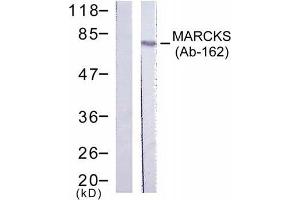 Western blot analysis of extract from HeLa cells, using MARCKS (Ab-162) antibody (E021257). (MARCKS antibody)