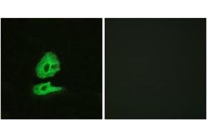 Immunofluorescence analysis of HeLa cells, using GLR Antibody.