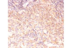 IHC-P: IKK alpha antibody testing of rat spleen tissue (IKK alpha antibody  (AA 411-745))