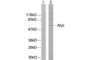 Western blot analysis of extracts from ovary cancer cells using Myc (Ab-58) antibody (E021034). (c-MYC antibody)