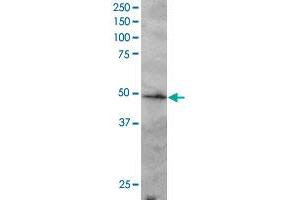 IRF2 polyclonal antibody  staining (2 ug/mL) of Jurkat lysate (RIPA buffer, 30 ug total protein per lane). (IRF2 antibody  (C-Term))
