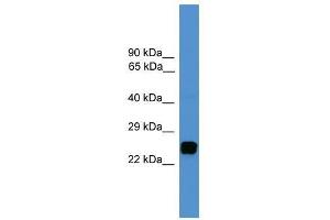 UCHL1 antibody used at 0. (UCHL1 antibody  (C-Term))