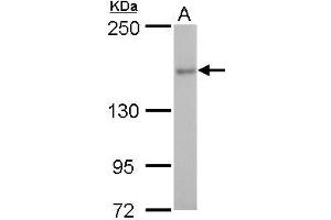 Western Blotting (WB) image for anti-rho-Associated, Coiled-Coil Containing Protein Kinase 2 (ROCK2) antibody (ABIN2855440)