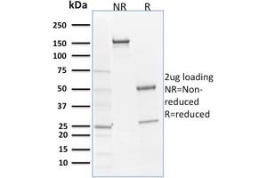 SDS-PAGE Analysis Purified SOX9 Mouse Monoclonal Antibody (SOX9/2398). (SOX9 antibody  (AA 393-508))