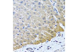 Immunohistochemistry of paraffin-embedded human liver using ARSF antibody at dilution of 1:100 (40x lens). (ARSF antibody)