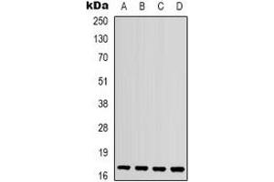 Western blot analysis of IL-1F10 expression in mouse kidney (A), mouse heart (B), mouse brain (C), rat spleen (D) whole cell lysates. (IL1F10 antibody  (C-Term))