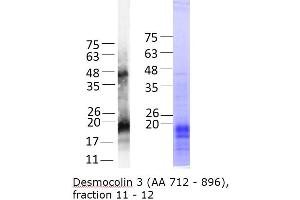 Image no. 3 for Desmocollin 3 (DSC3) (AA 712-896) protein (His tag) (ABIN3079072)