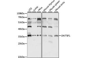 Western blot analysis of extracts of various cell lines, using DNTTIP1 antibody (ABIN7266731) at 1:1000 dilution. (DNTTIP1 antibody  (AA 1-329))