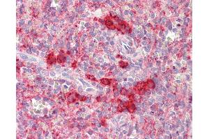 Anti-TSHZ2 antibody IHC staining of human spleen. (TSHZ2 antibody  (N-Term))