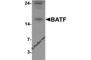 Western Blotting (WB) image for anti-Basic Leucine Zipper ATF-like Transcription Factor (BATF) (N-Term) antibody (ABIN1077388) (BATF antibody  (N-Term))