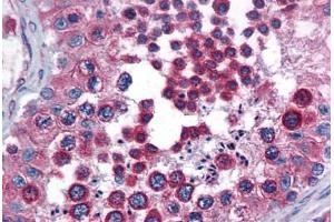 Human Testis: Formalin-Fixed, Paraffin-Embedded (FFPE) (Calnexin antibody  (AA 204-218))